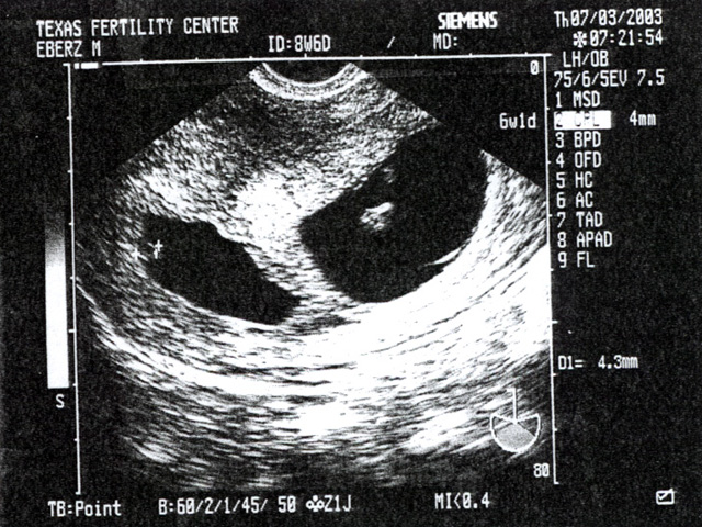 Mojo's Fetus 2